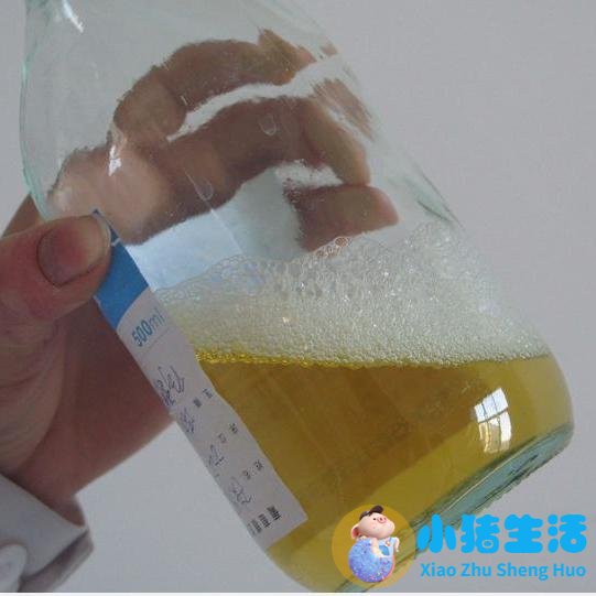 检验单箭头后都藏着什么病？来这里，医生教你读懂体检报告