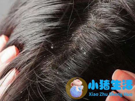 防脱生发最好的产品