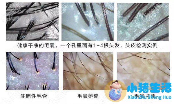 防脱生发最好的产品