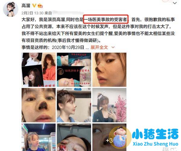 <strong>24岁女星整形致毁容！鼻头化脓发黑坏死</strong>