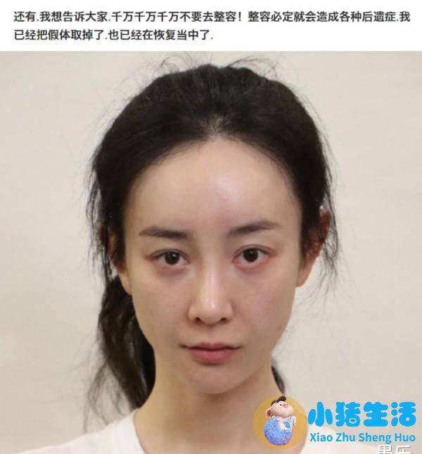 伊美尚整形毁容案例
