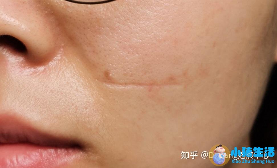 伊美尚整形毁容案例