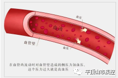 健康饮食食谱怎样预防高血压