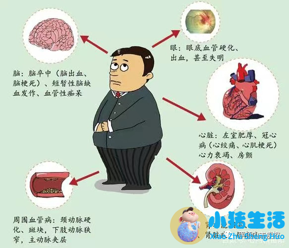 健康饮食食谱怎样预防高血压