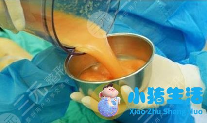 背部吸脂减肥手术费用需要多少钱