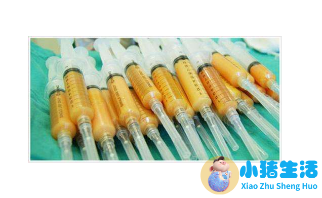 背部吸脂减肥手术费用需要多少钱