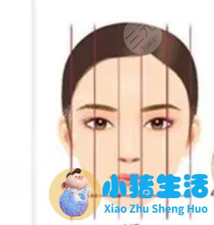 鼻翼过宽