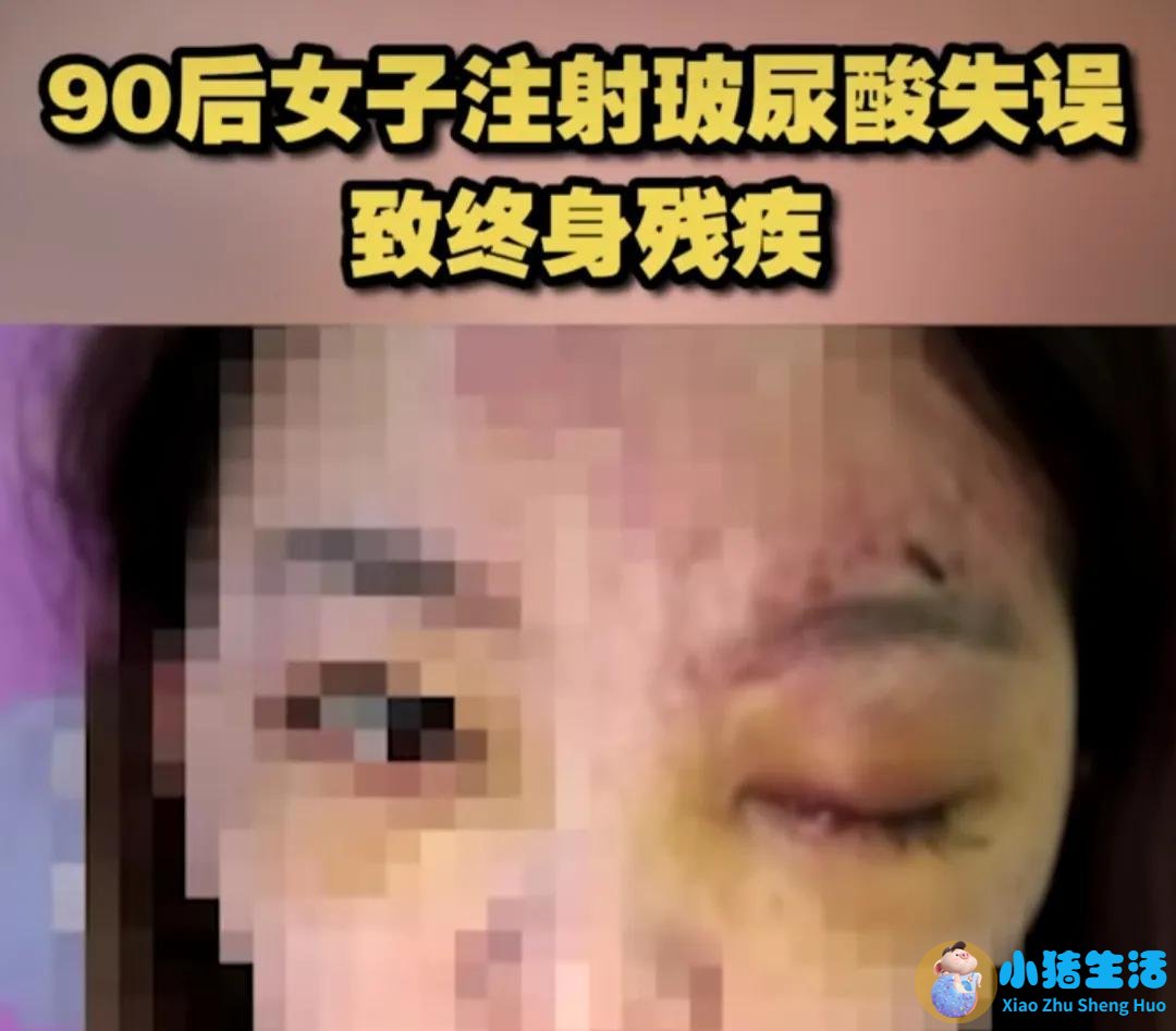 <strong>整容不慎成毁容，女子注射6针玻尿酸致残</strong>