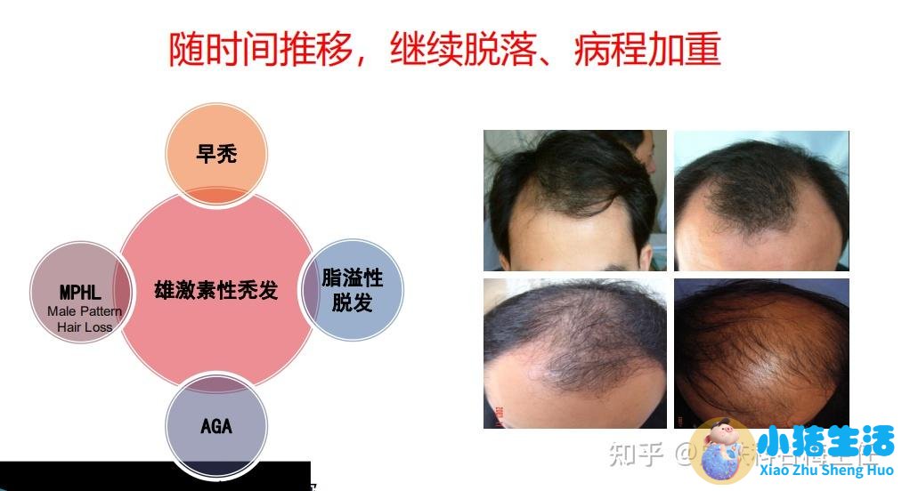 毛囊炎脱发头发长得慢