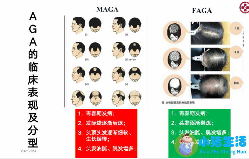 毛囊炎脱发头发长得慢