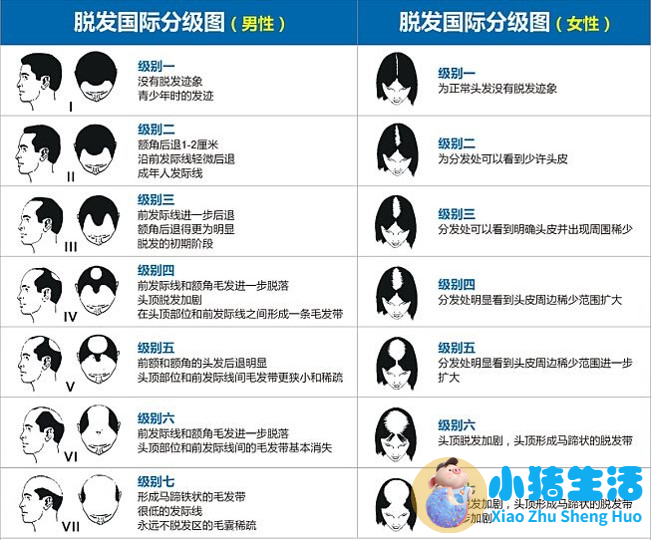毛囊炎脱发头发长得慢