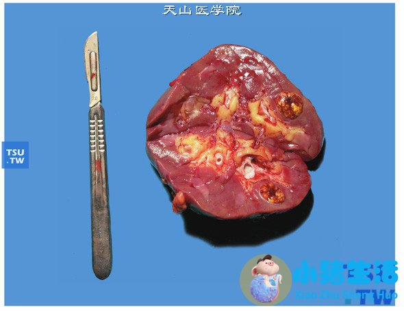 男性保健新知识