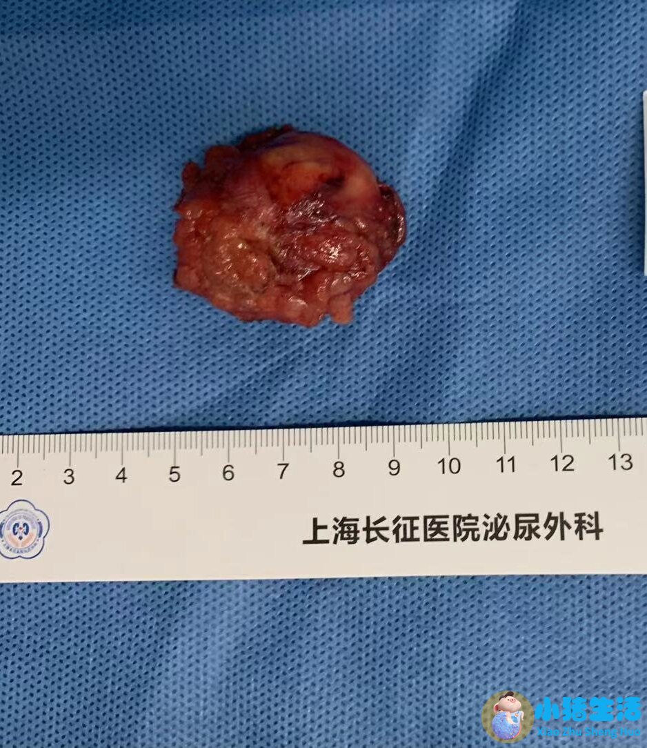 男性保健新知识