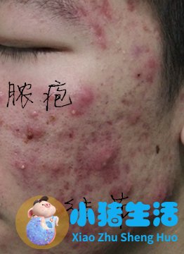 韩国护肝敏有副作用吗