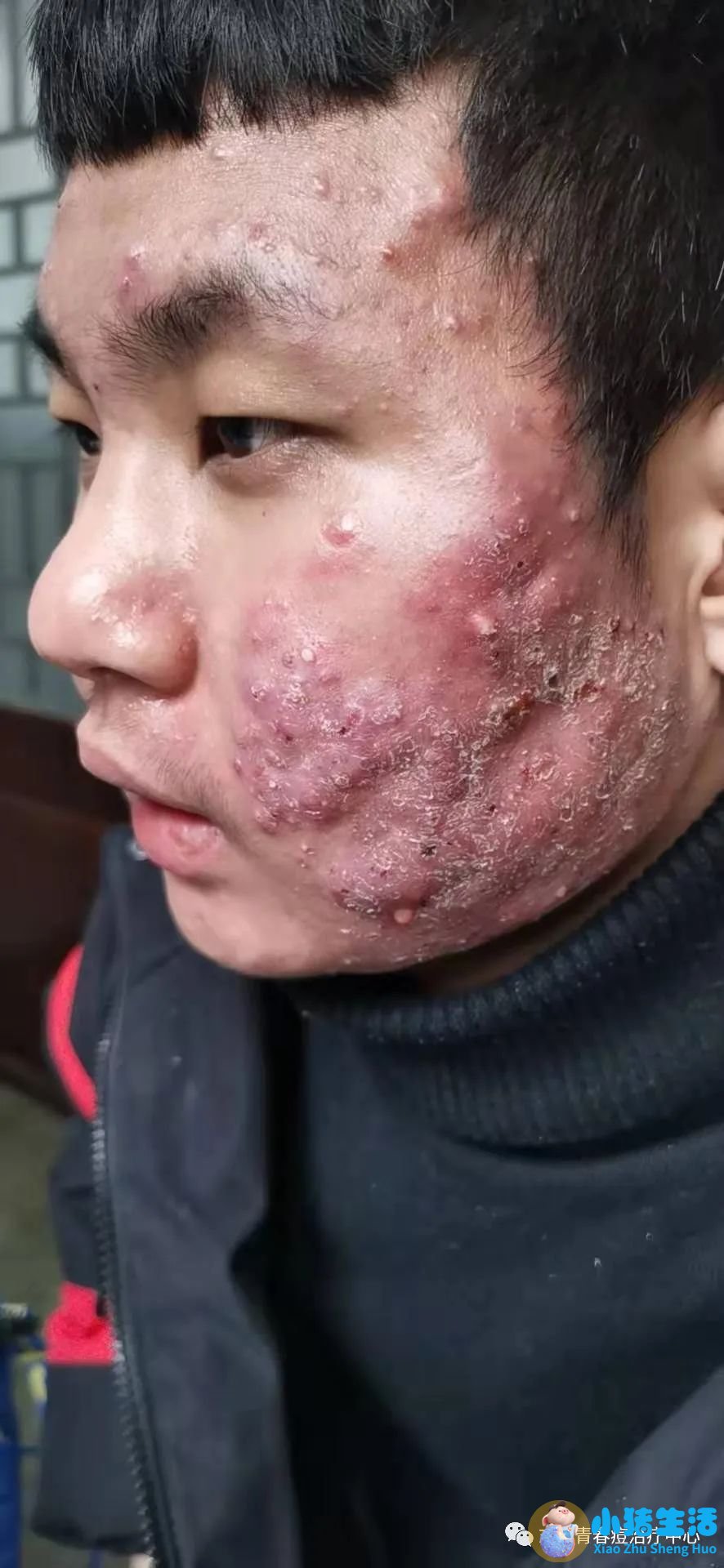 韩国护肝敏有副作用吗