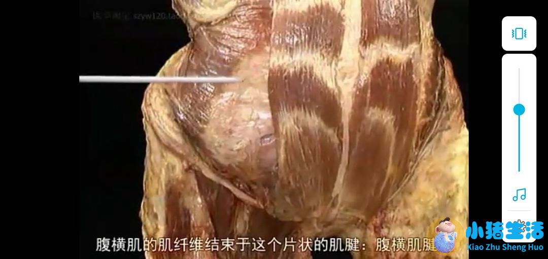 局部减肥有效果吗 腾讯较真实时辟谣