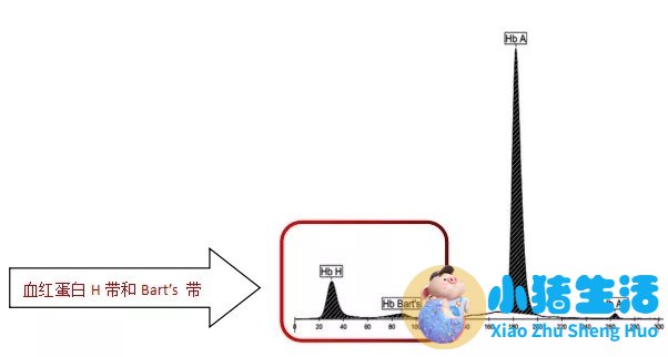 怀孕初筛地中海贫血异常