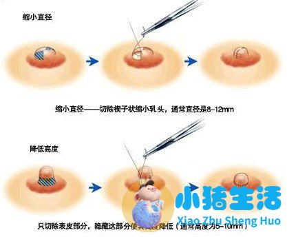 乳晕小是回事