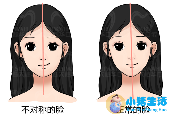 一边脸下垂是什么原因