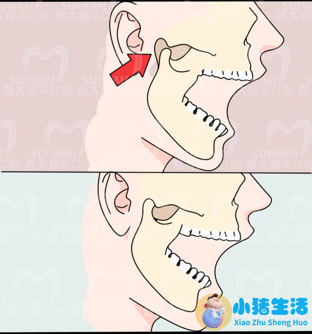 一边脸下垂是什么原因