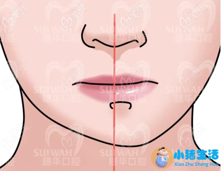 一边脸下垂是什么原因