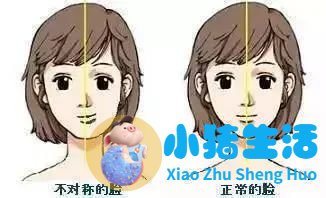 一边脸下垂是什么原因