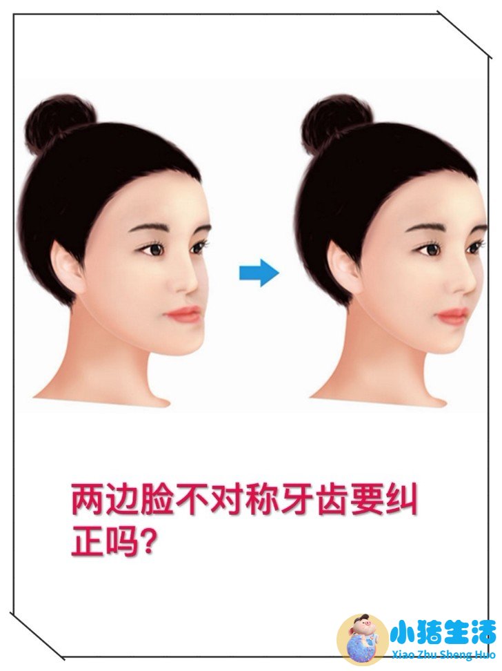 一边脸下垂是什么原因