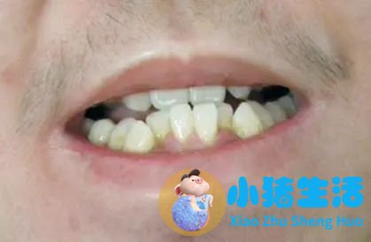 一边脸下垂是什么原因