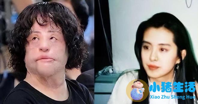 韩慧景因整容失败，发疯时往身体注射大