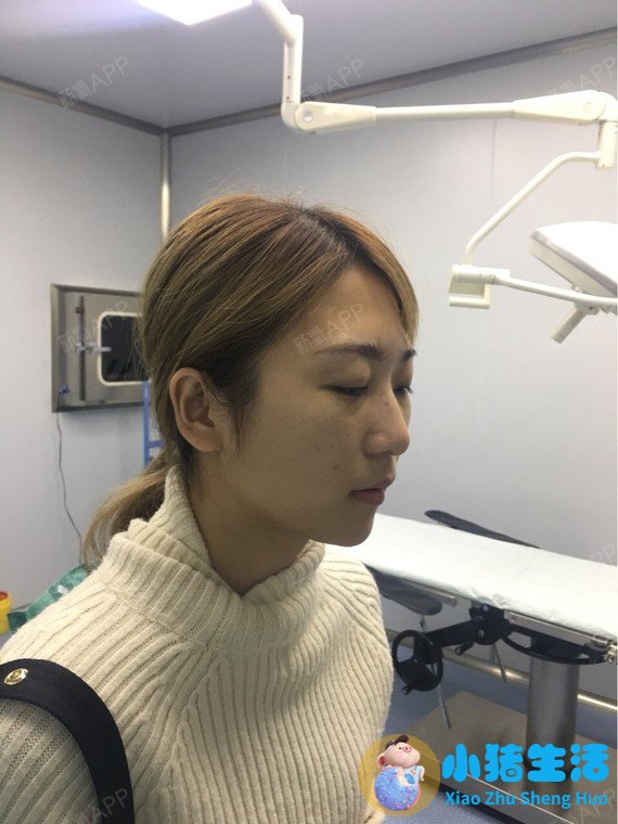 韩国私密整形失败案例