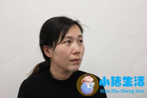韩国私密整形失败案例