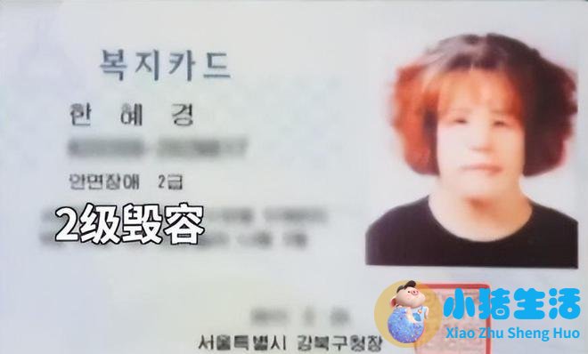 韩国私密整形失败案例