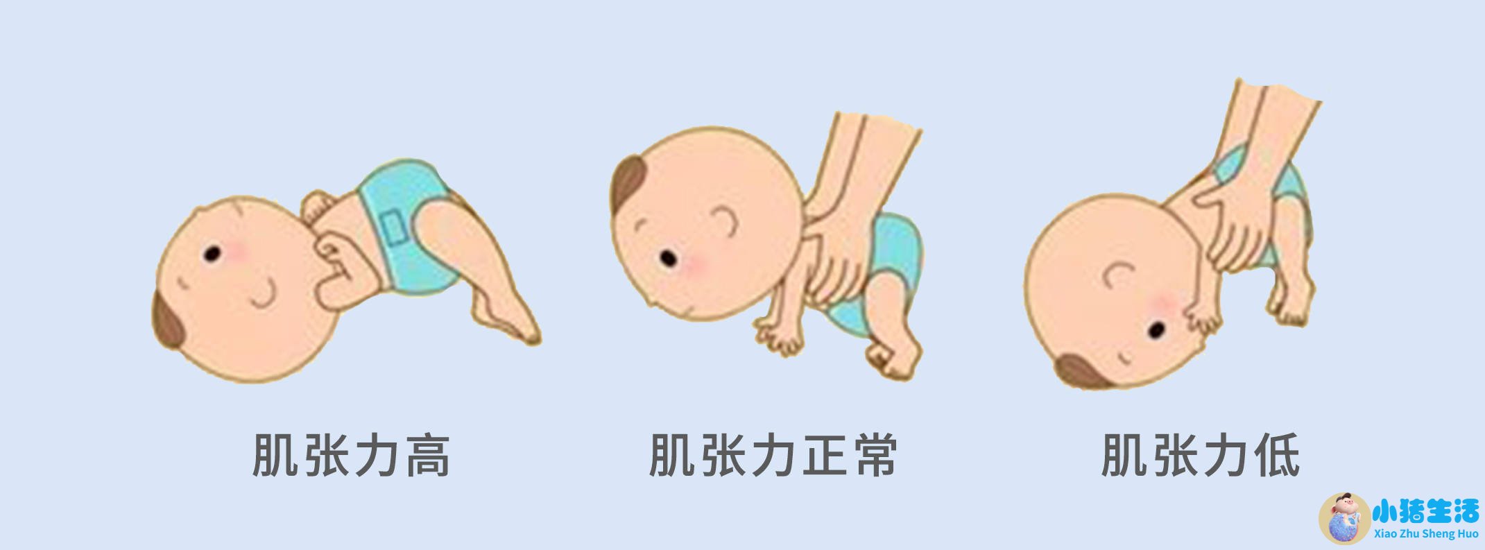 新生儿脑瘫可以治好吗