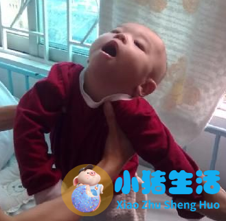 新生儿脑瘫可以治好吗