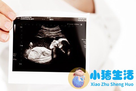 怀孕八个月，彩超医生说孩子腿长，暗示