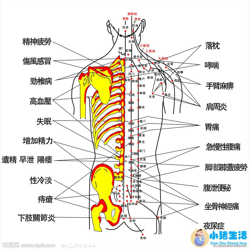 针灸局部减肥
