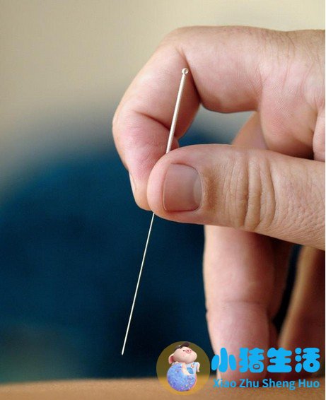 针灸局部减肥