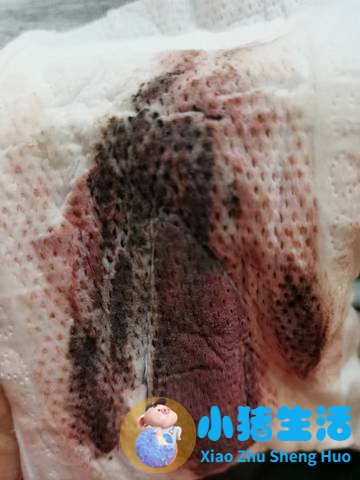 性激素六项正常月经量少影响怀孕吗