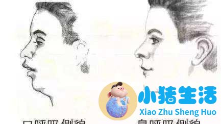 新生儿老是鼻塞会怎样