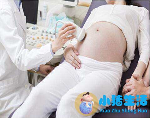 孕16周没感觉担心胎停