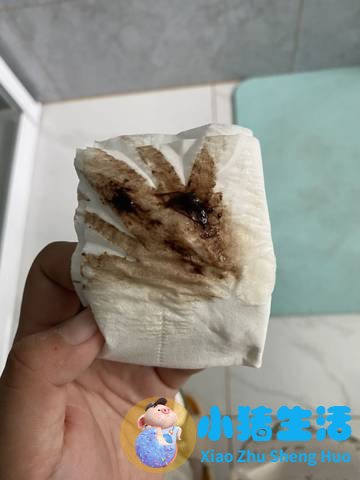 孕16周没感觉担心胎停