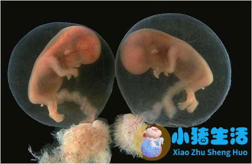 孕16周没感觉担心胎停