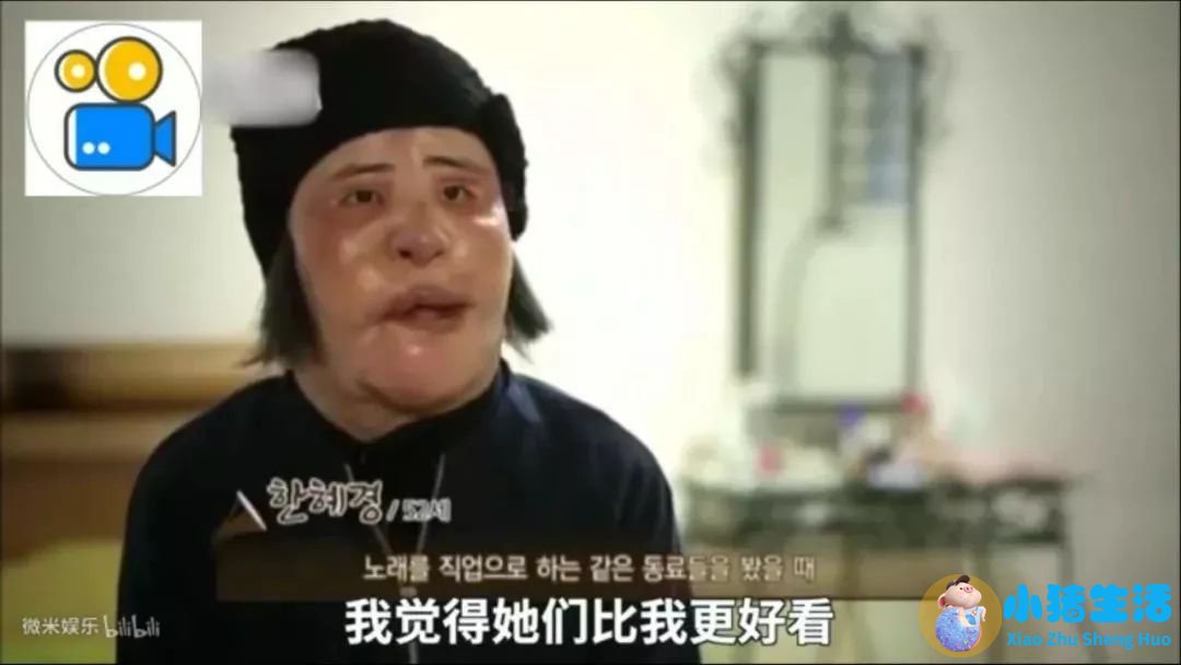 济南海峡整形失败案例