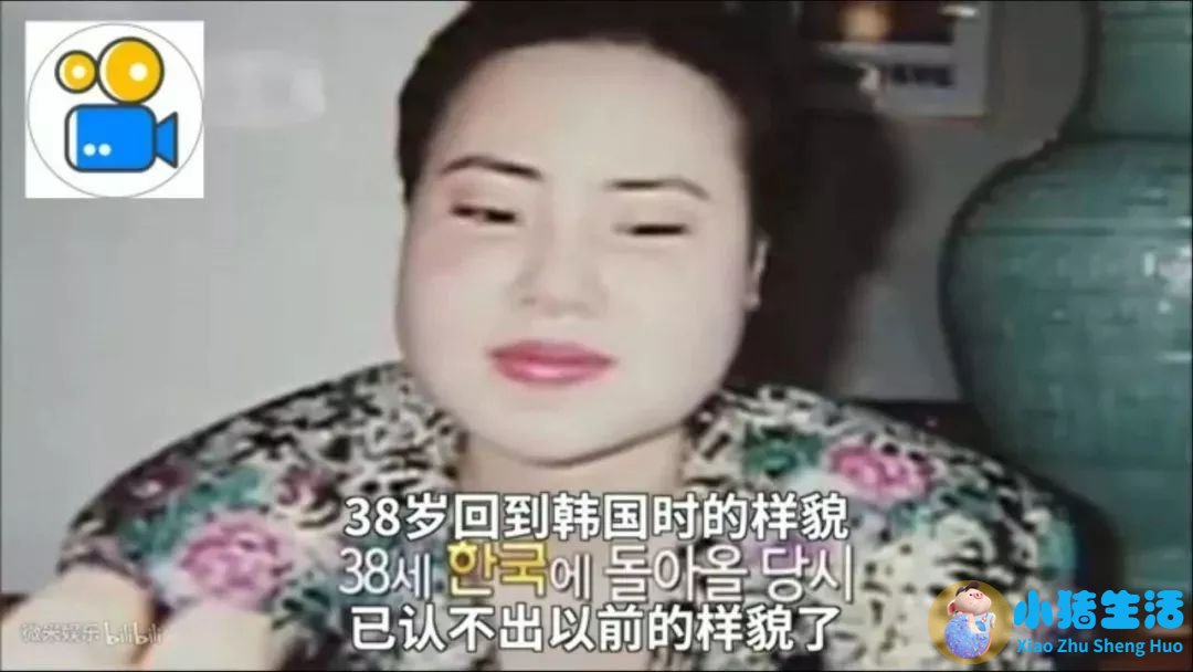 济南海峡整形失败案例