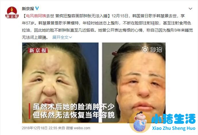 济南海峡整形失败案例