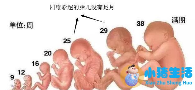 怀孕17周胎儿真实图片