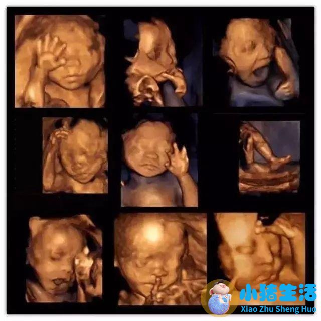 怀孕17周胎儿真实图片