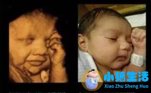怀孕17周胎儿真实图片