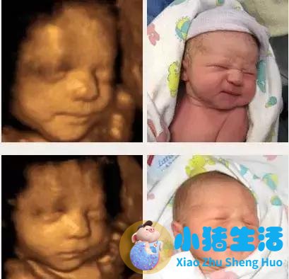 怀孕17周胎儿真实图片