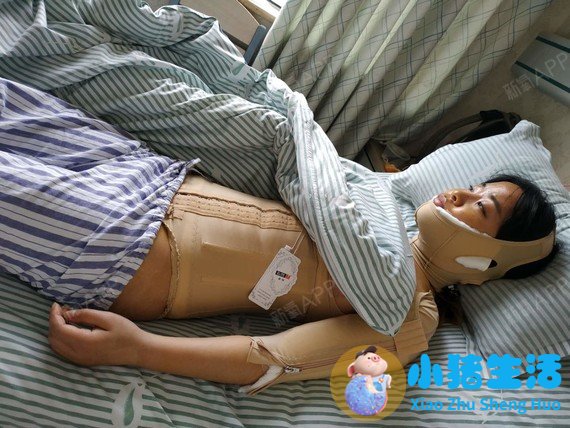 悦美网整形案例图片